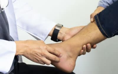 What You Need to Know About Total Ankle Replacement
