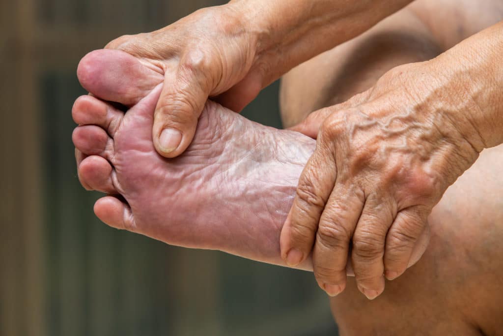 What to Do About Diabetic Feet Swelling | Foot & Ankle Clinics of Arizona