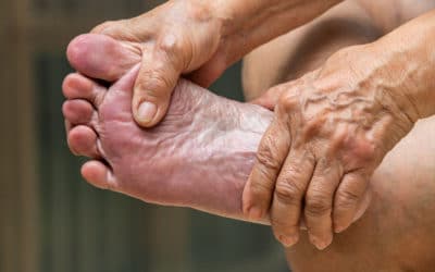 What to Do About Painful or Uncomfortable Swelling in Diabetic Feet