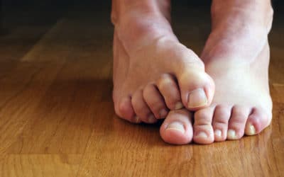 How to Improve Circulation to Your Feet