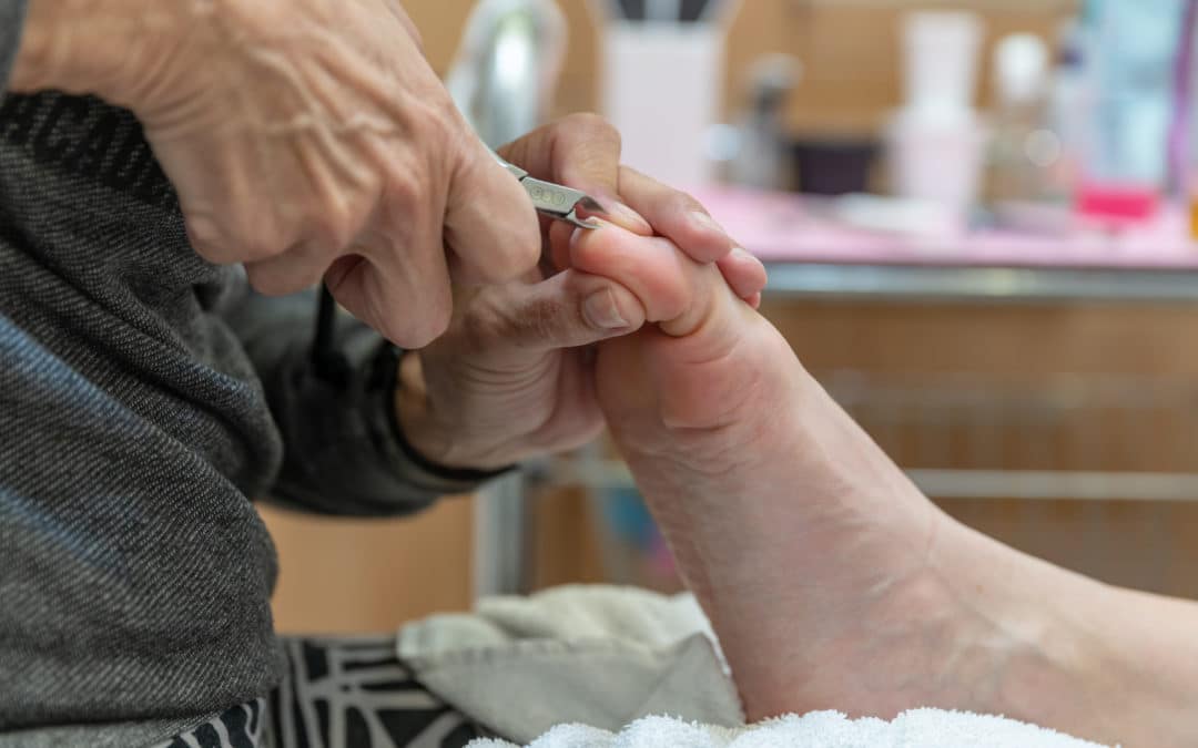 How Do You Treat an Ingrown Toenail?